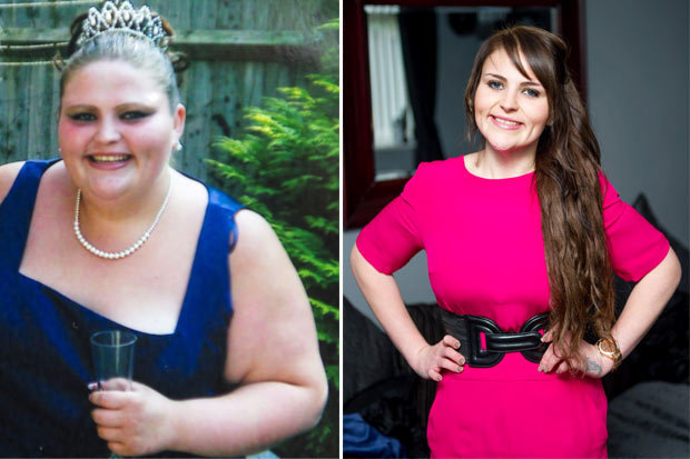 A-after -befor weight loss (2)